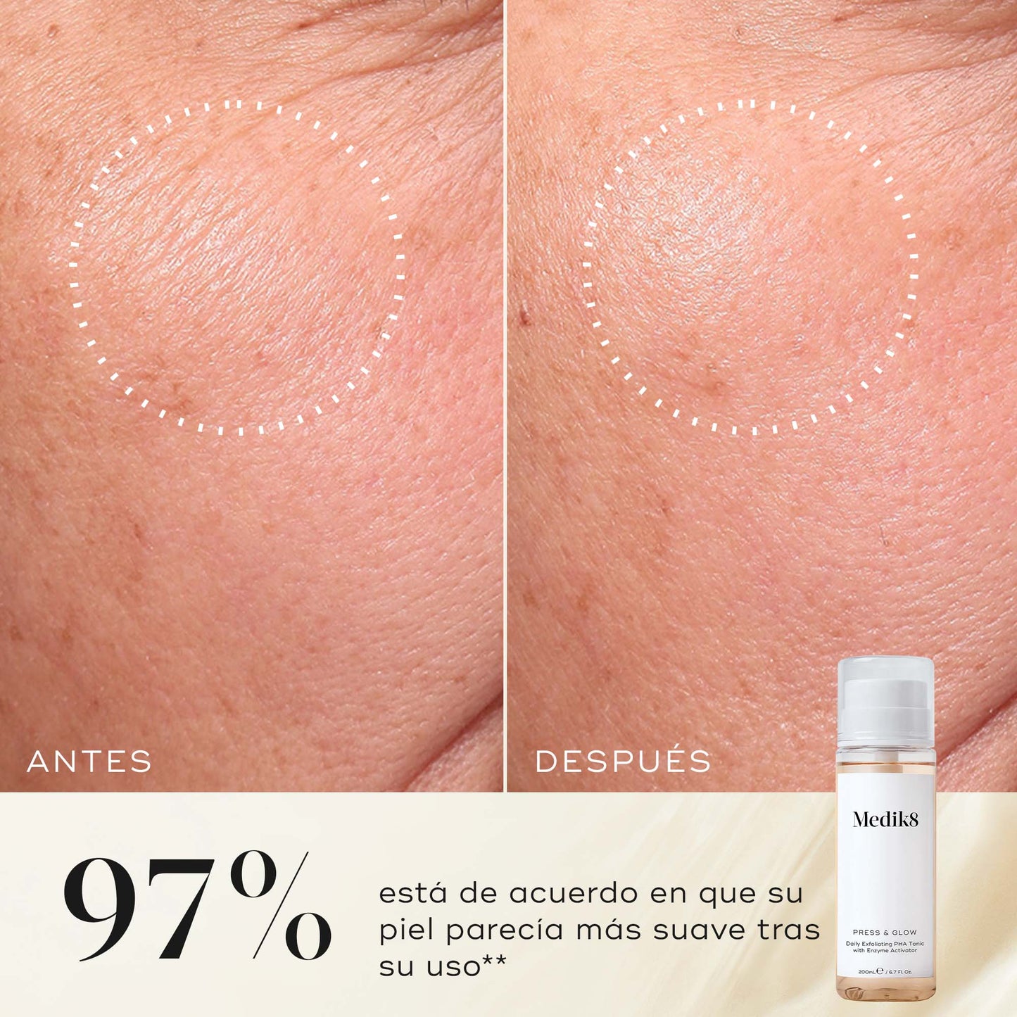 resultados Press & Glow