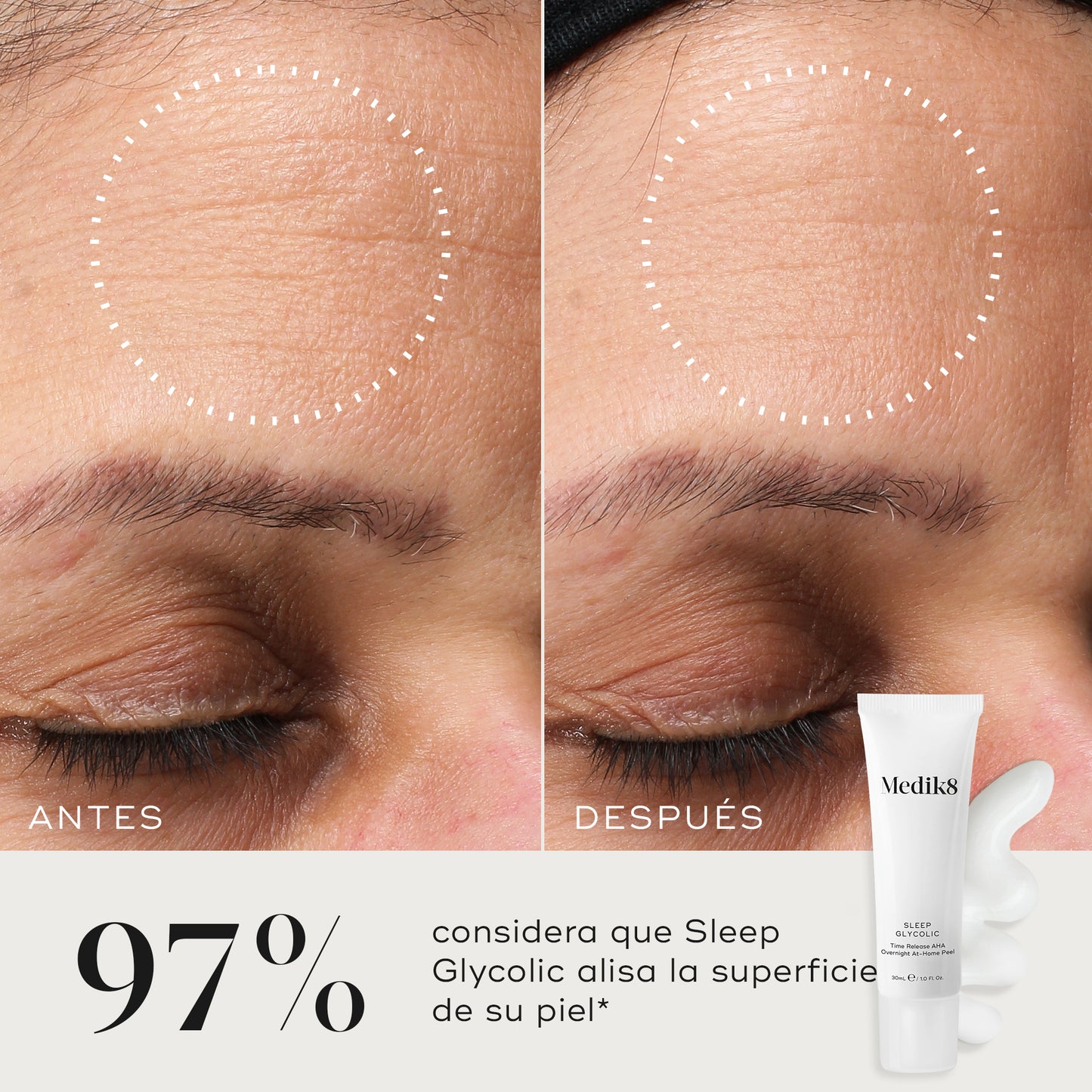 Resultados Sleep Glycolic