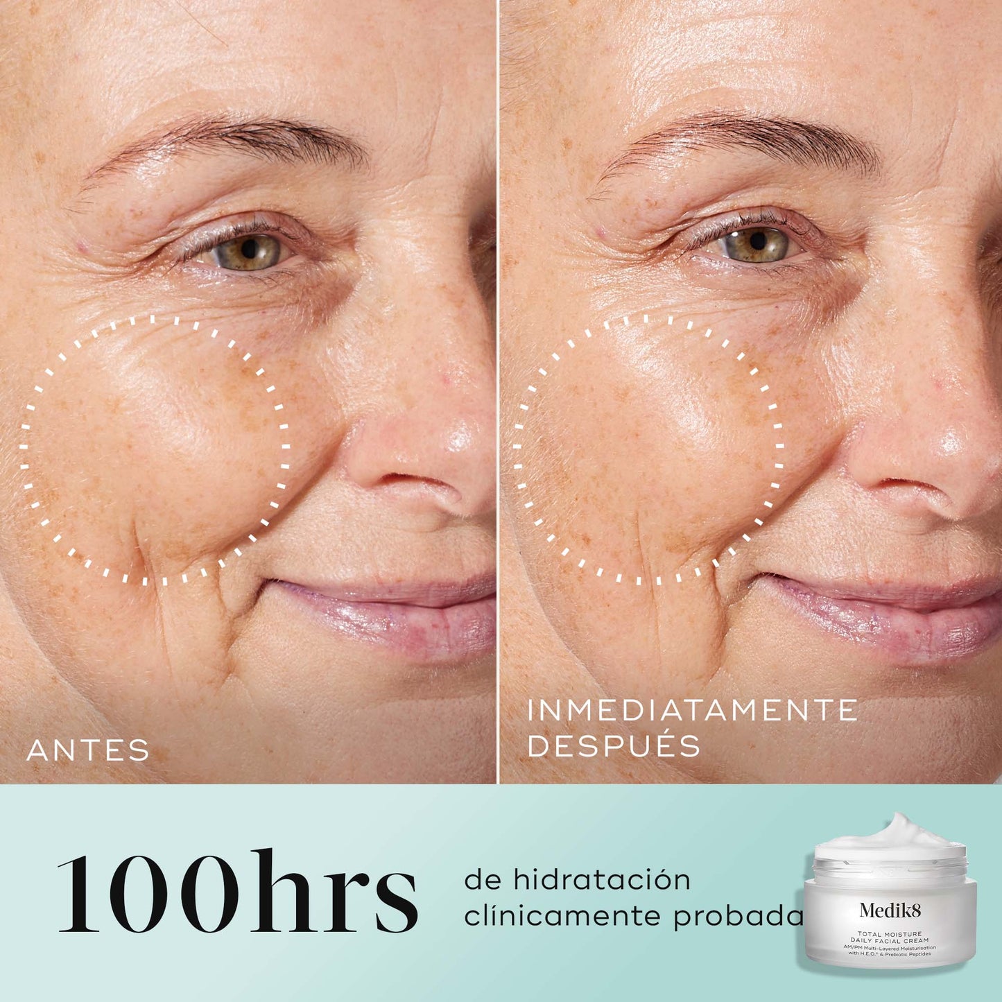 resultados Total Moisture Daily Facial Cream
