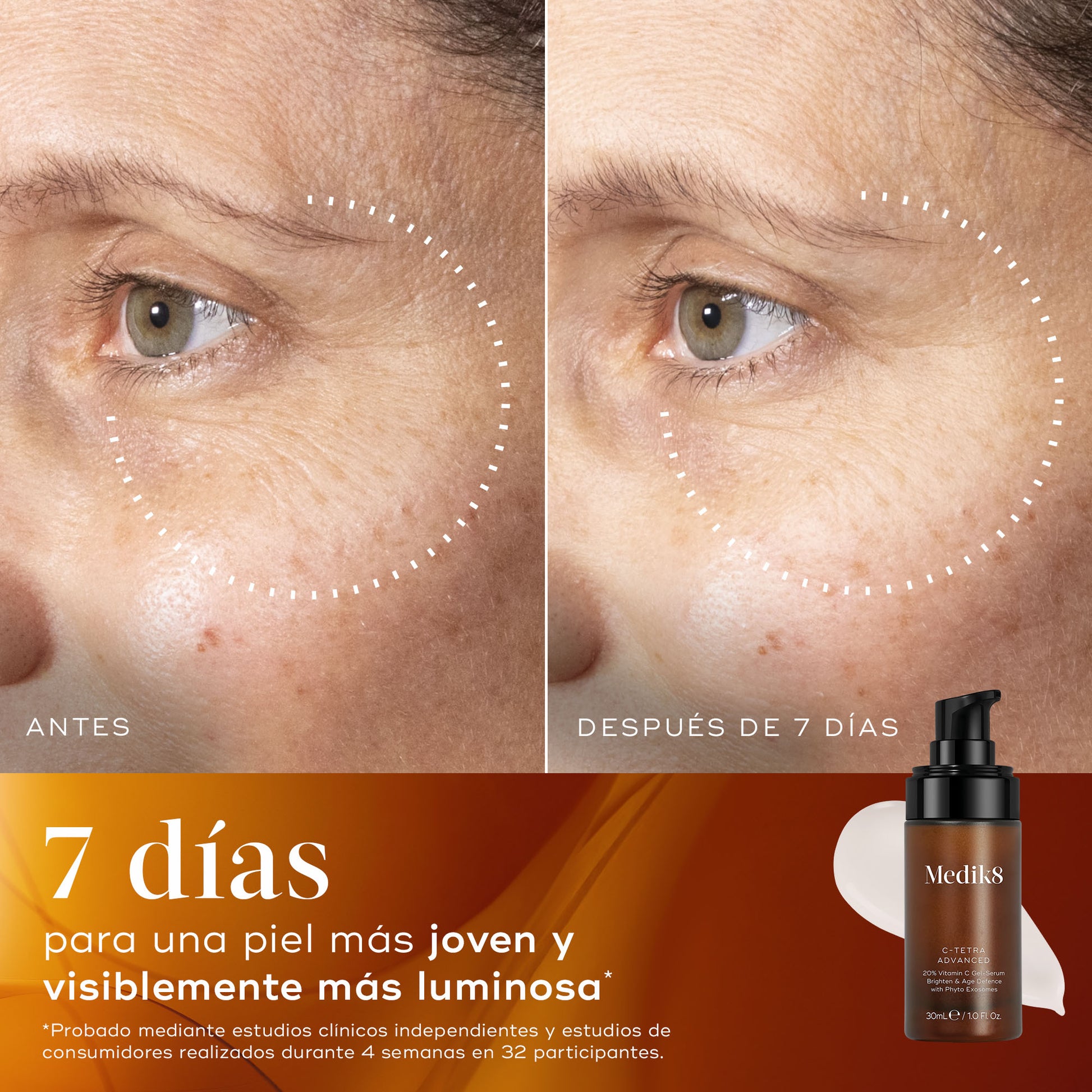 c-tetra advanced resultados