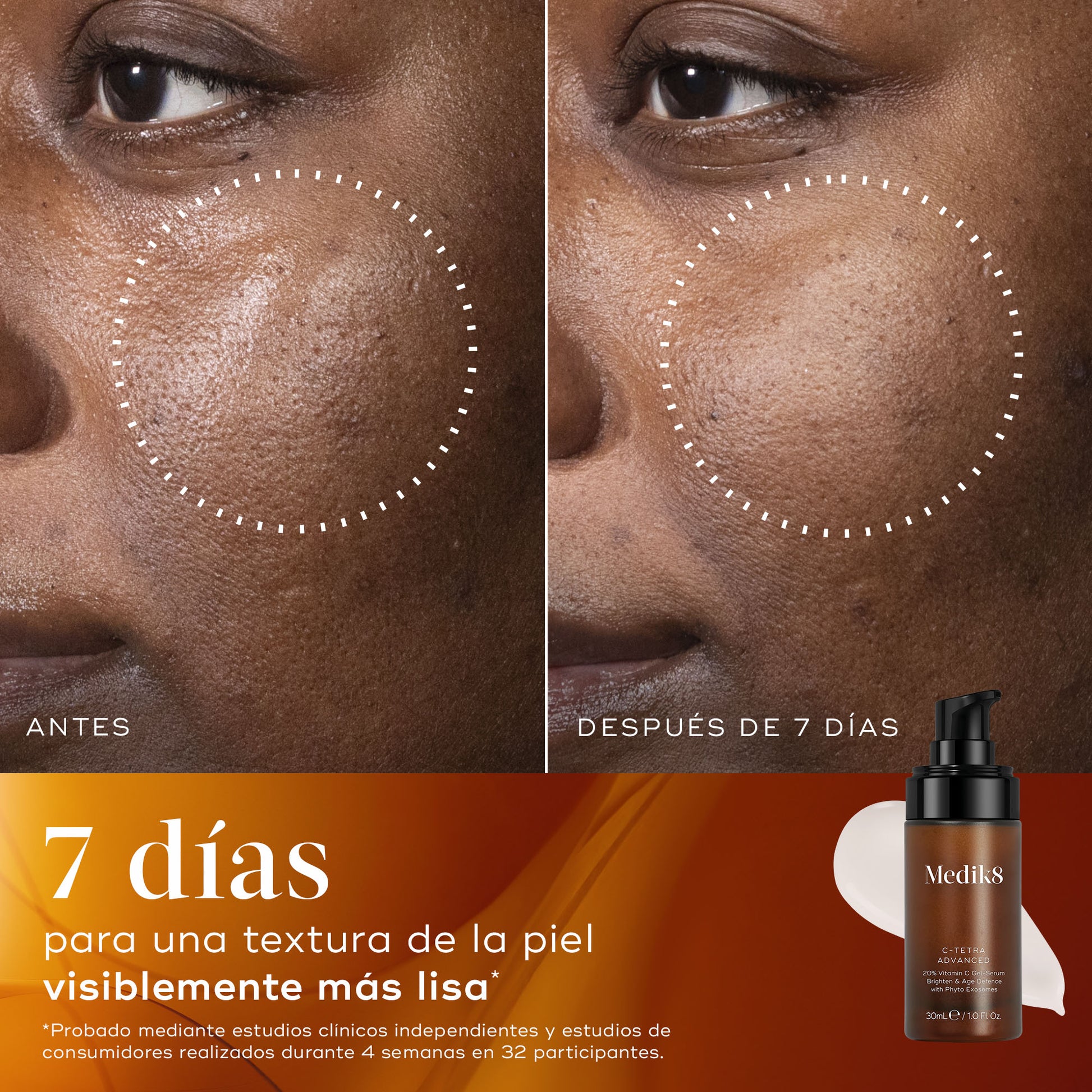 c-tetra advanced eficacia