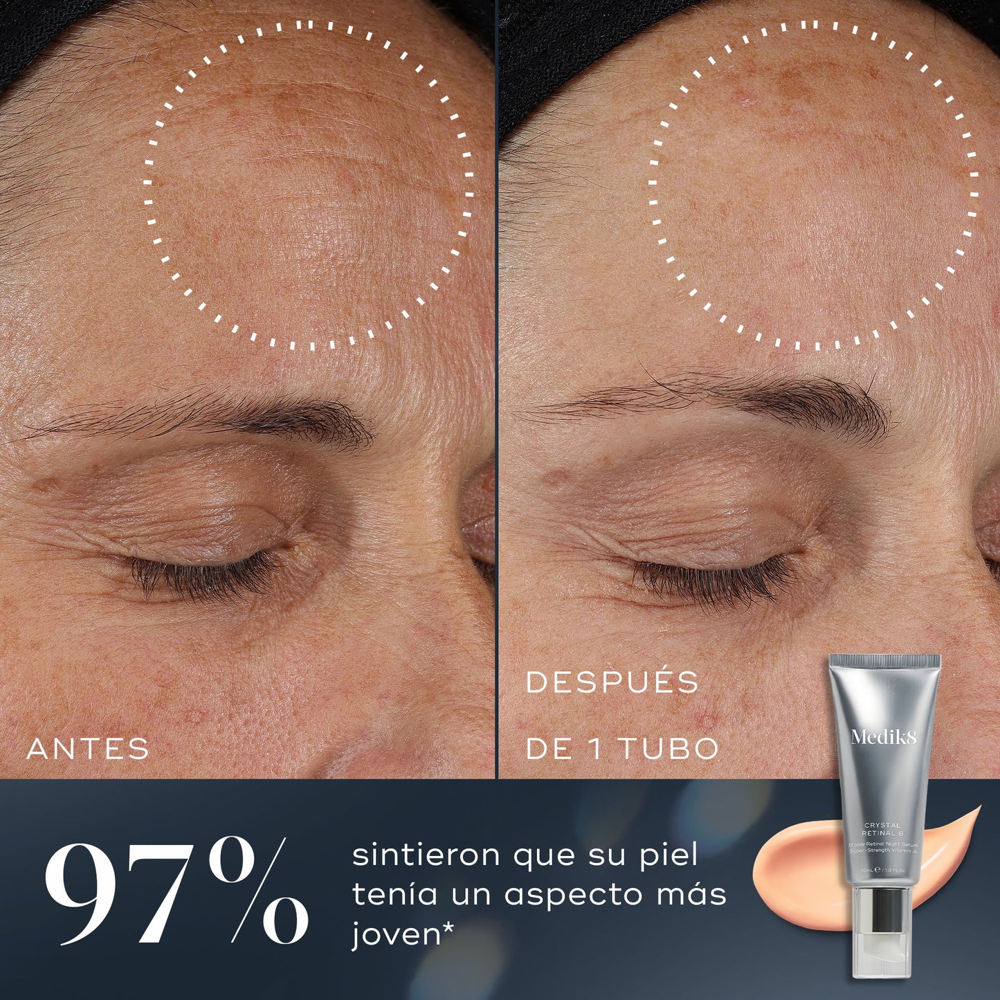 Medik 8 Crystal Retinal resultados