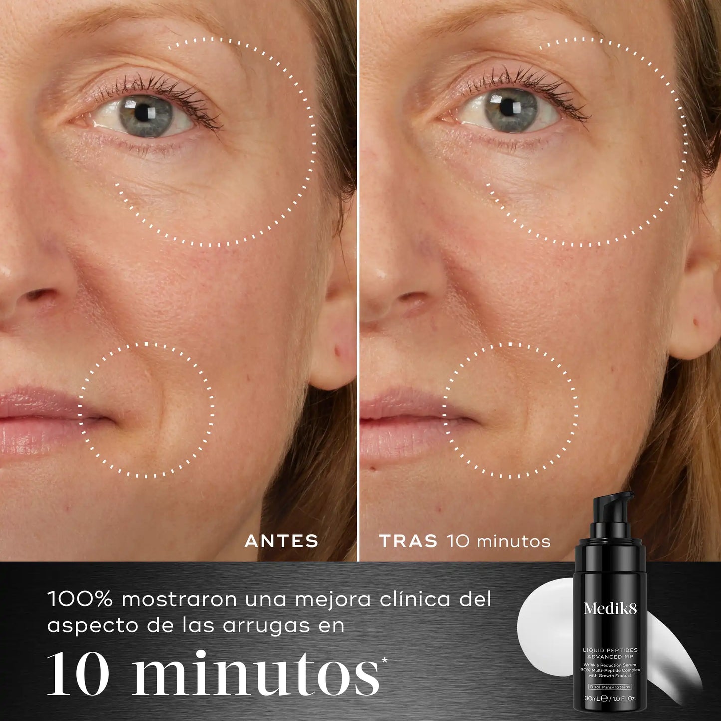 resultados Liquid Peptides Advanced