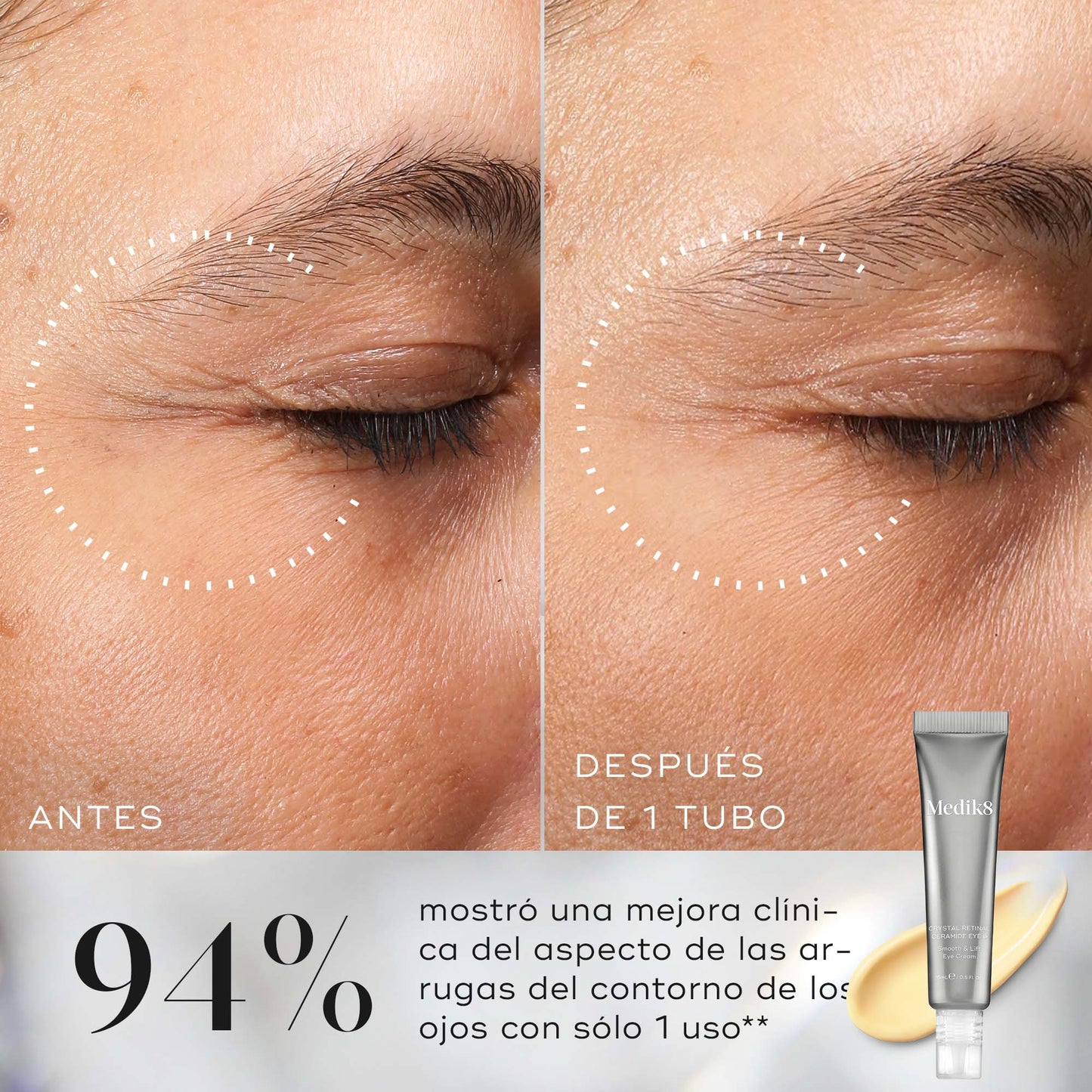 resultados Crystal Retinal Ceramid Eye