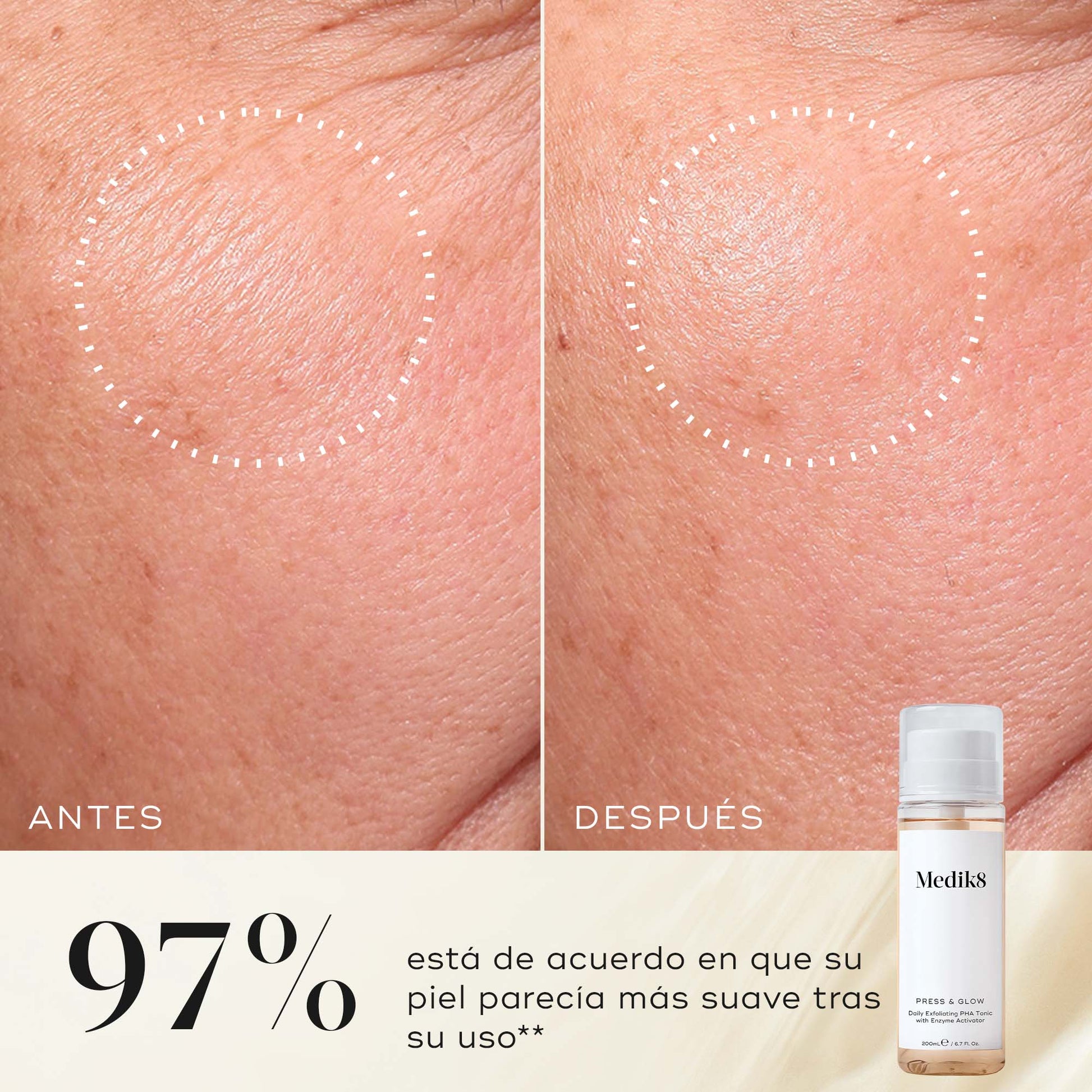 resultados Press & Glow