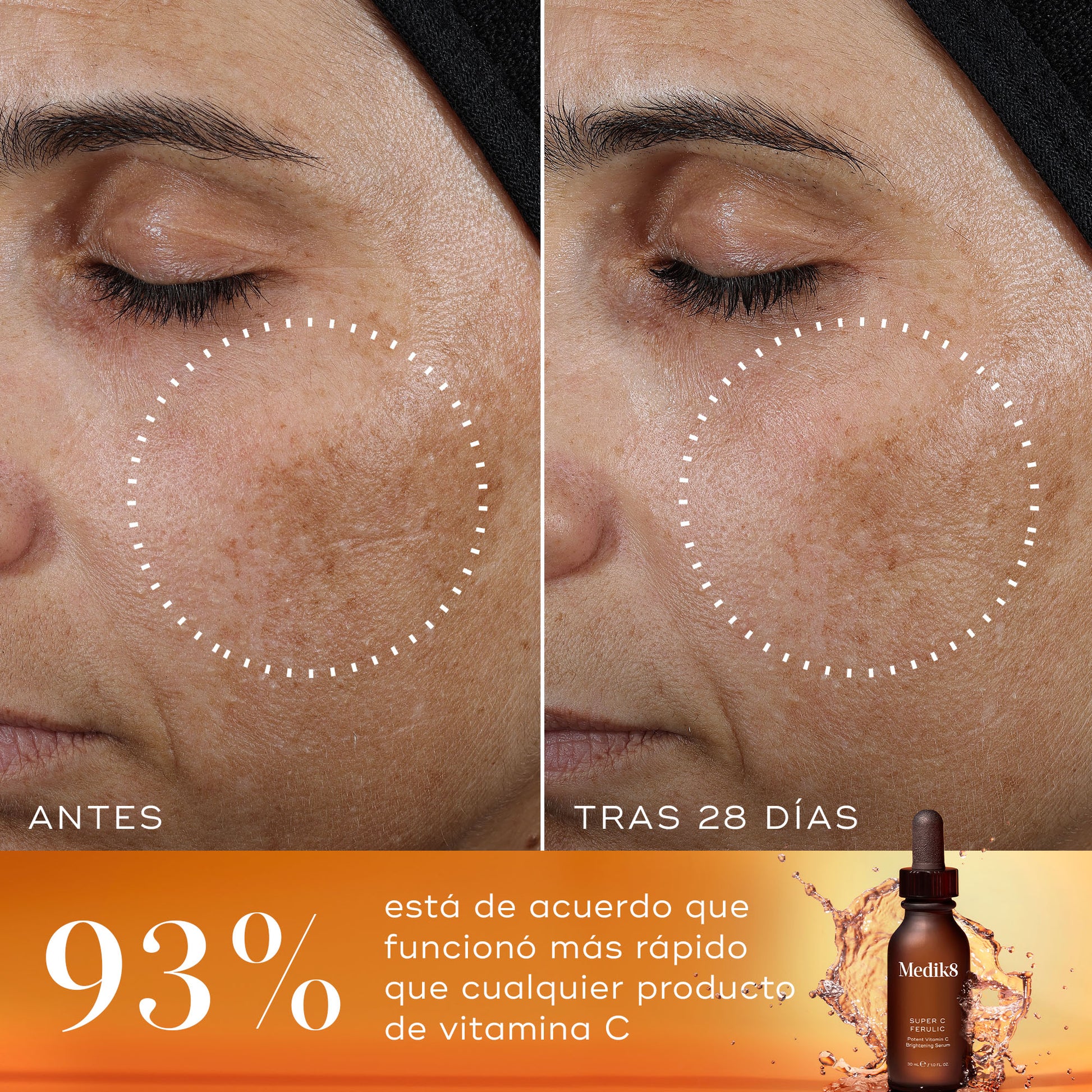 resultados Super C Ferulic
