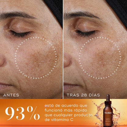 resultados Super C Ferulic